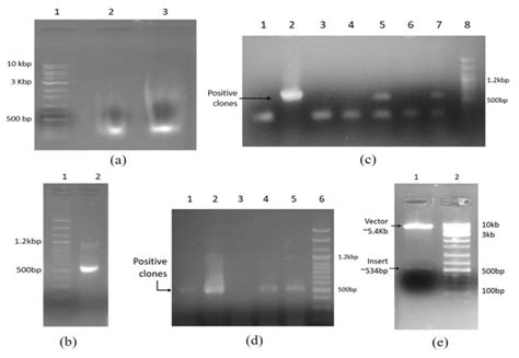 interpretation of dna gel electrophoresis results|Gel electrophoresis (article) .